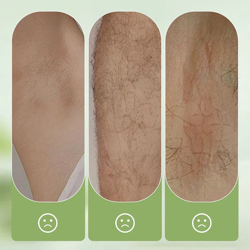 Gentle and non-irritating hair removal cream