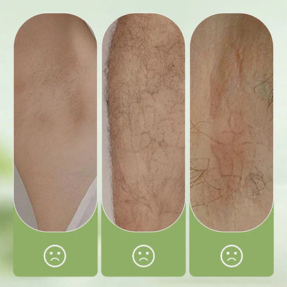 Gentle and non-irritating hair removal cream