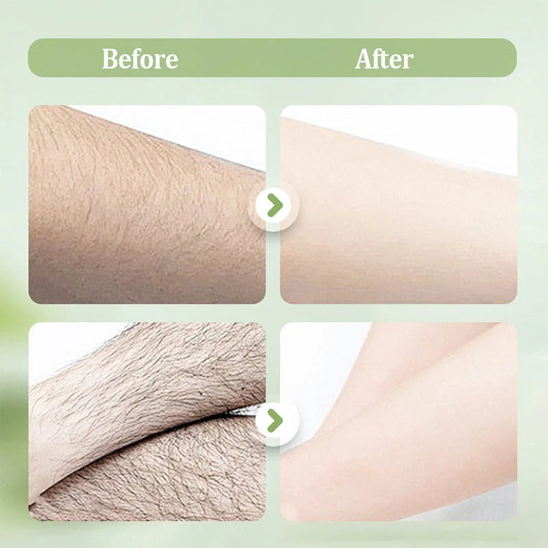Gentle and non-irritating hair removal cream