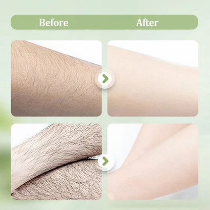 Gentle and non-irritating hair removal cream